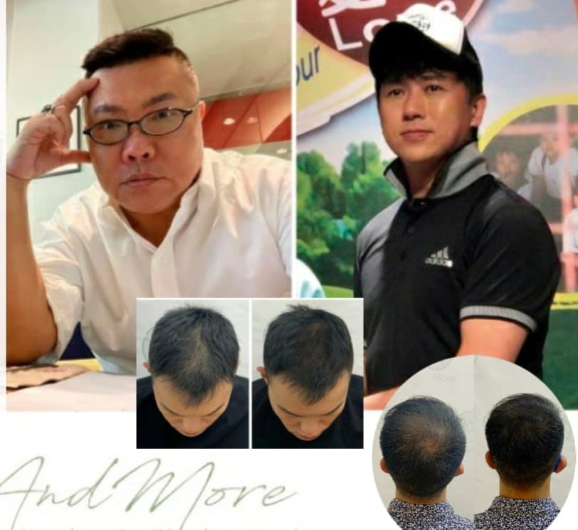 AndMore SMP 紋髮真實個案 before / after