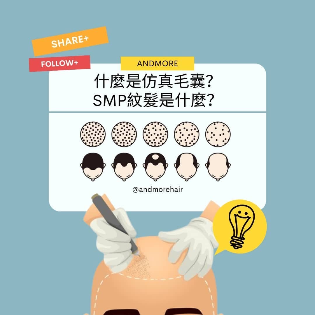 AndMore SMP紋髮專家 — 仿真毛囊效果